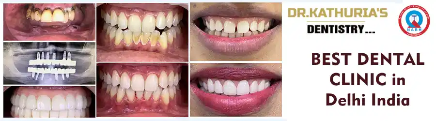 أفضل عيادة أسنان في دلهي أفضل عيادة أسنان في دلهي