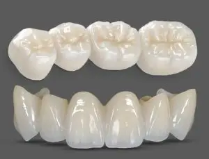 تاج وجسر زركونيا