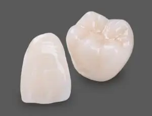 تاج وجسر سيراميك