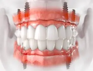 يزرع القاعدية