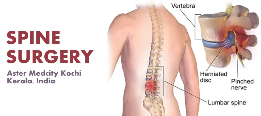 Spine Surgery Aster Medcity