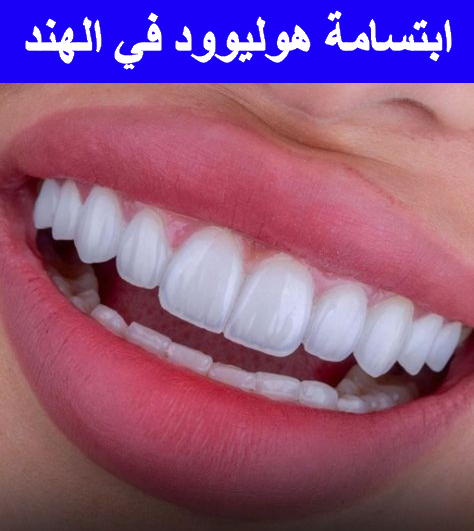 ابتسامة-هوليوود-في-الهند ابتسامة-هوليوود-في-الهند